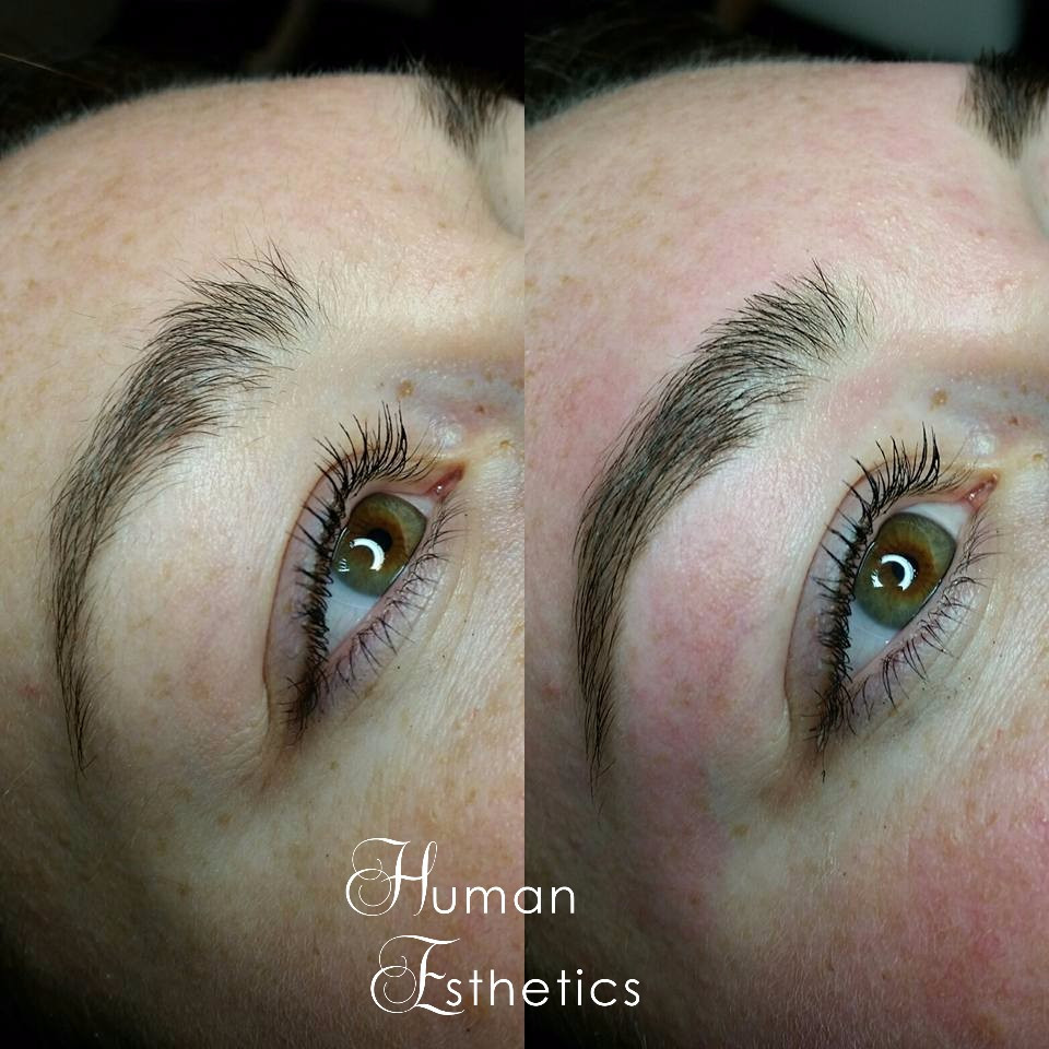photo - Human Esthetics