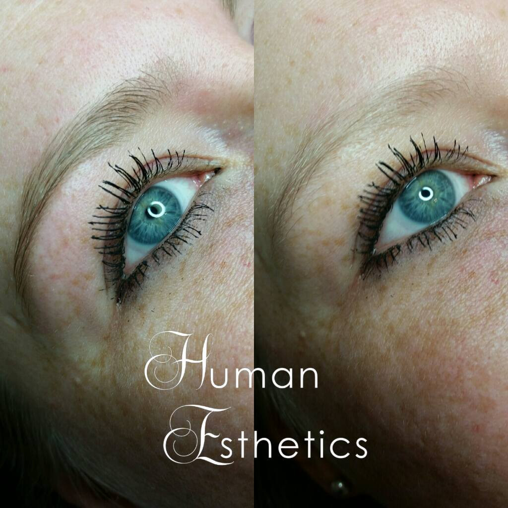photo - Human Esthetics