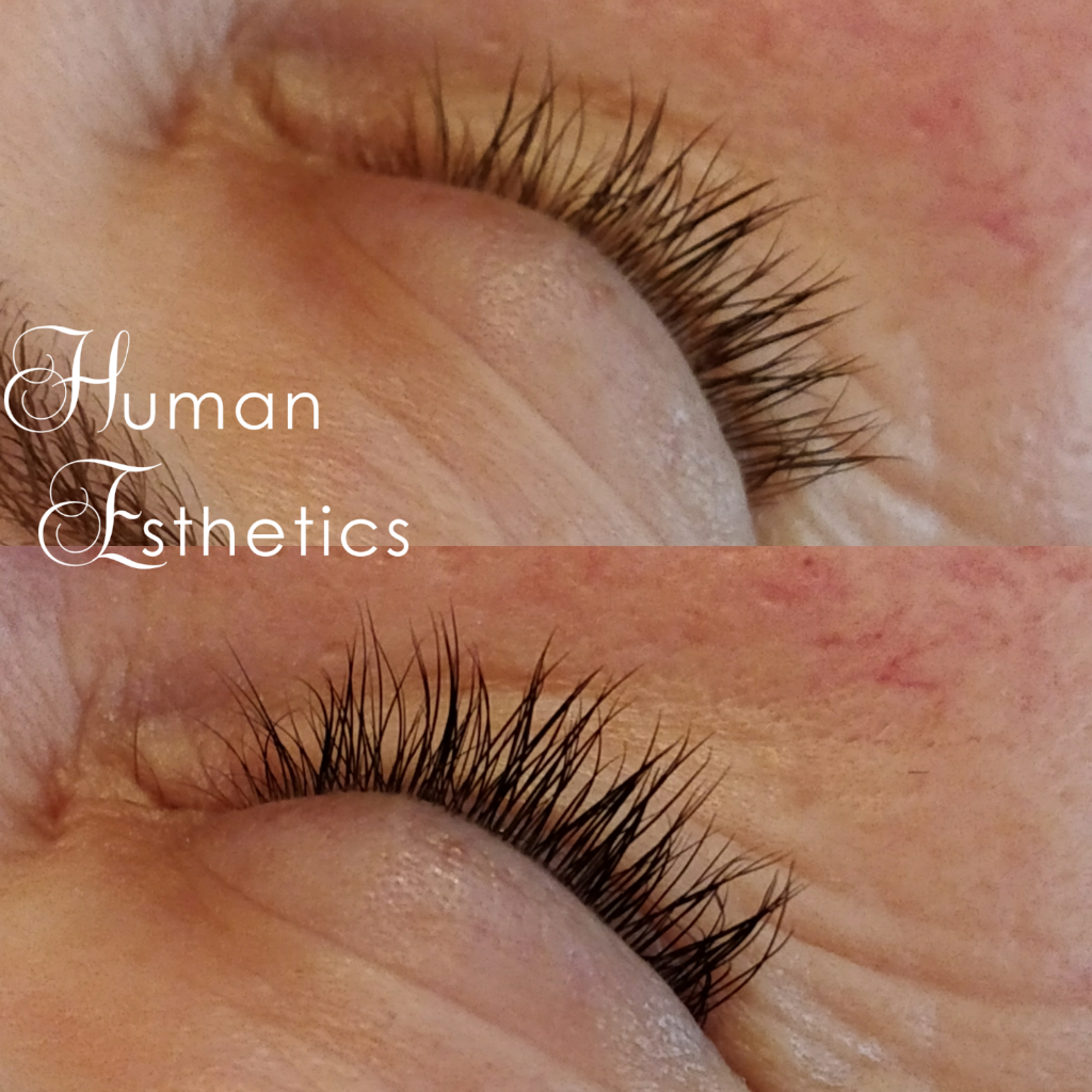 photo - Human Esthetics