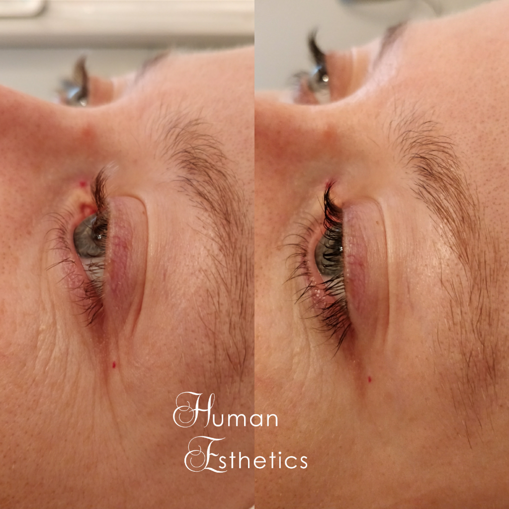 photo - Human Esthetics