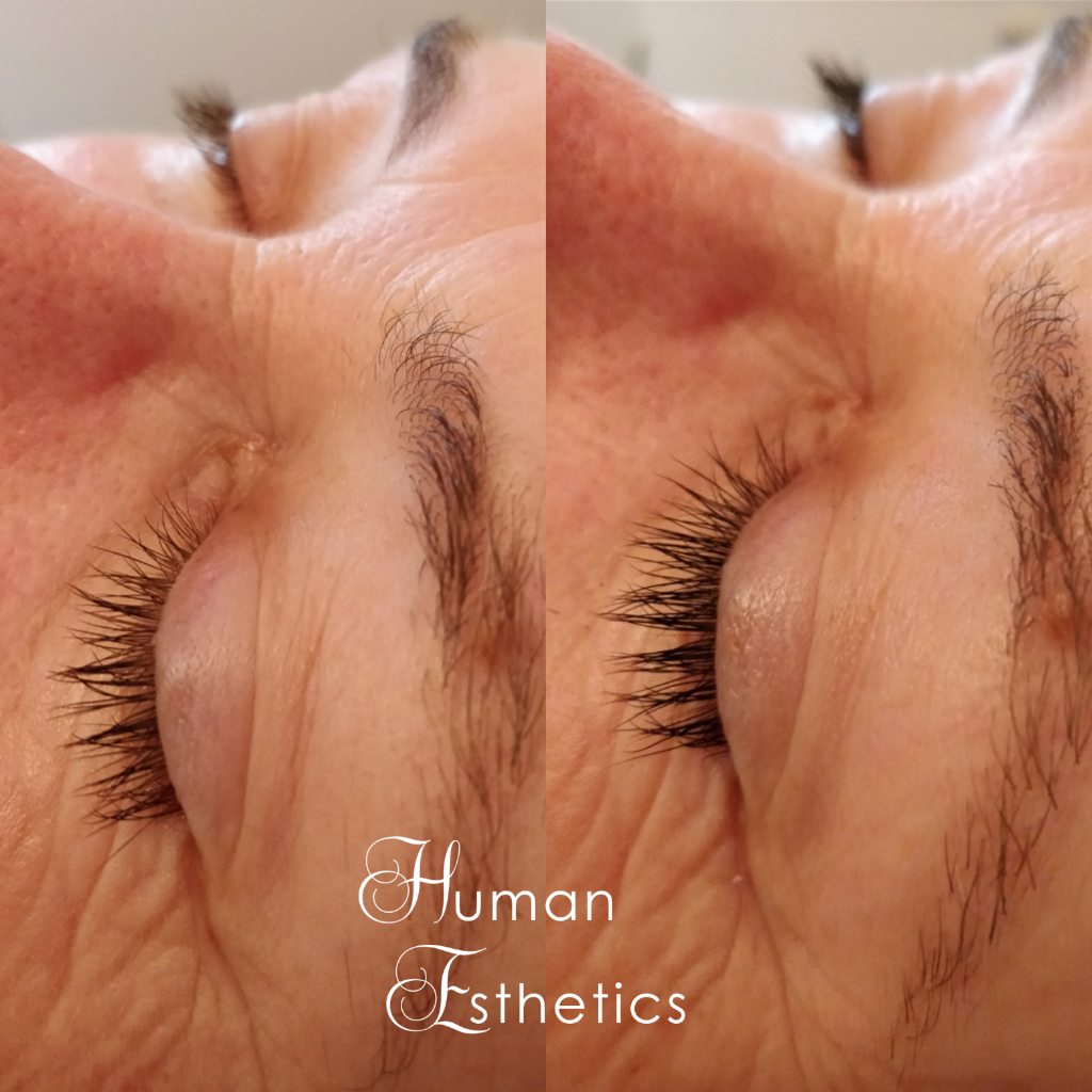 photo - Human Esthetics