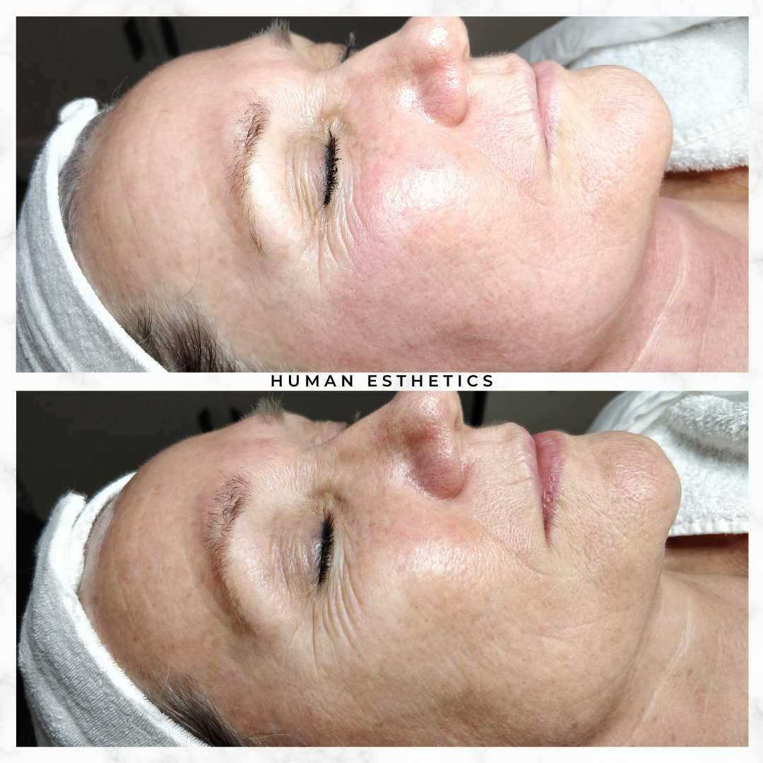 photo - Human Esthetics