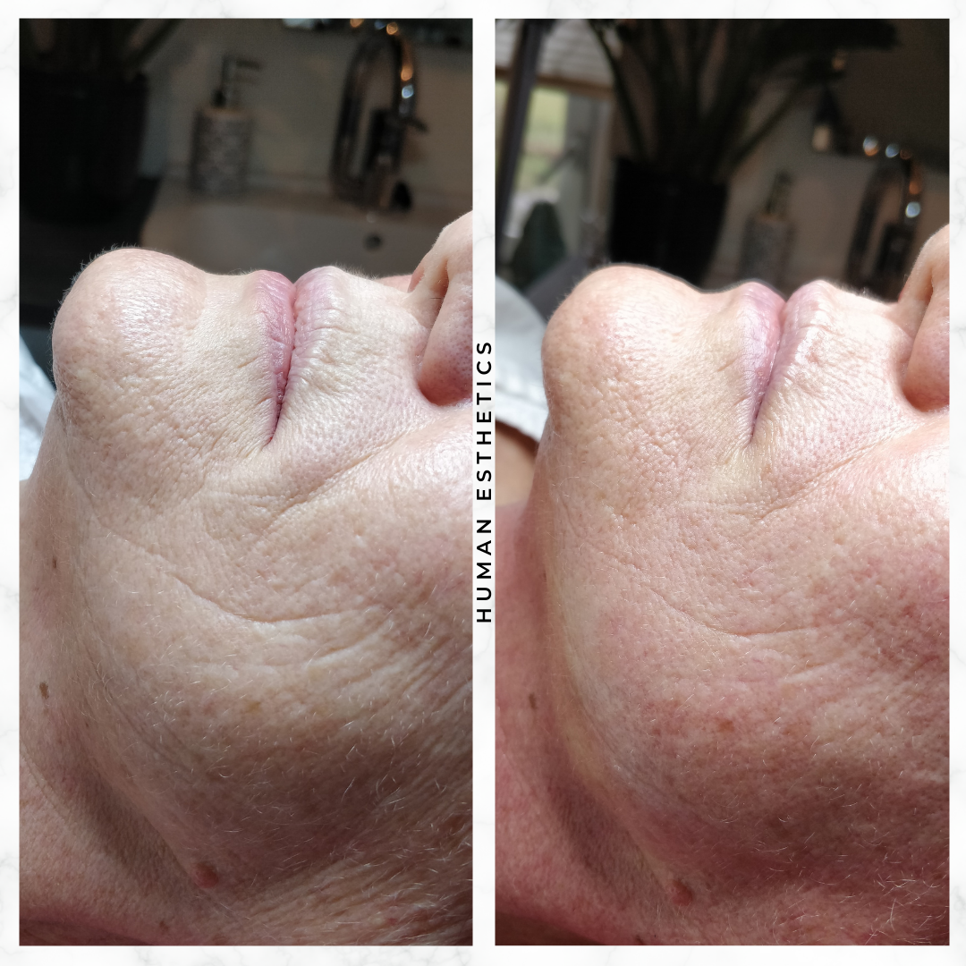 photo - Human Esthetics