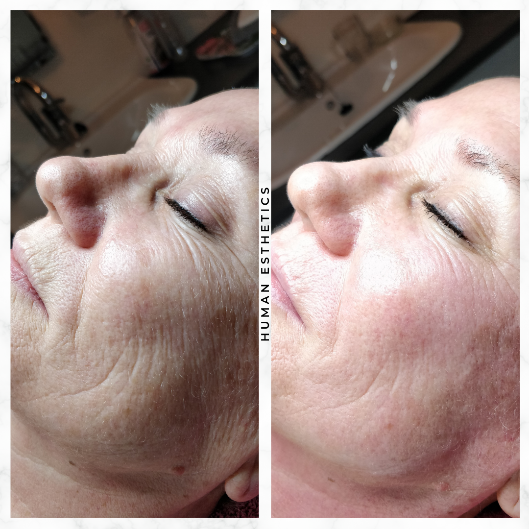 photo - Human Esthetics
