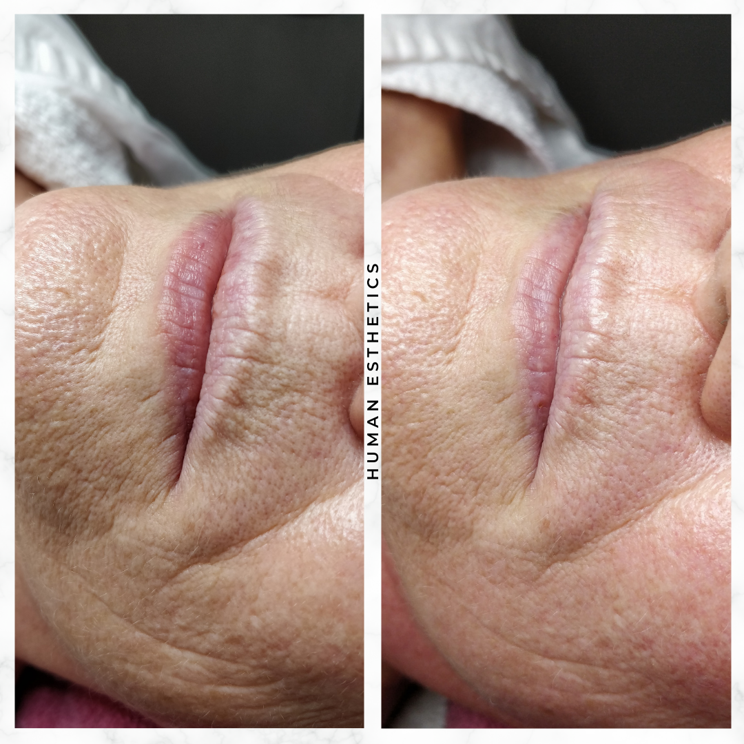 photo - Human Esthetics