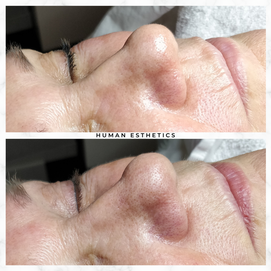 photo - Human Esthetics