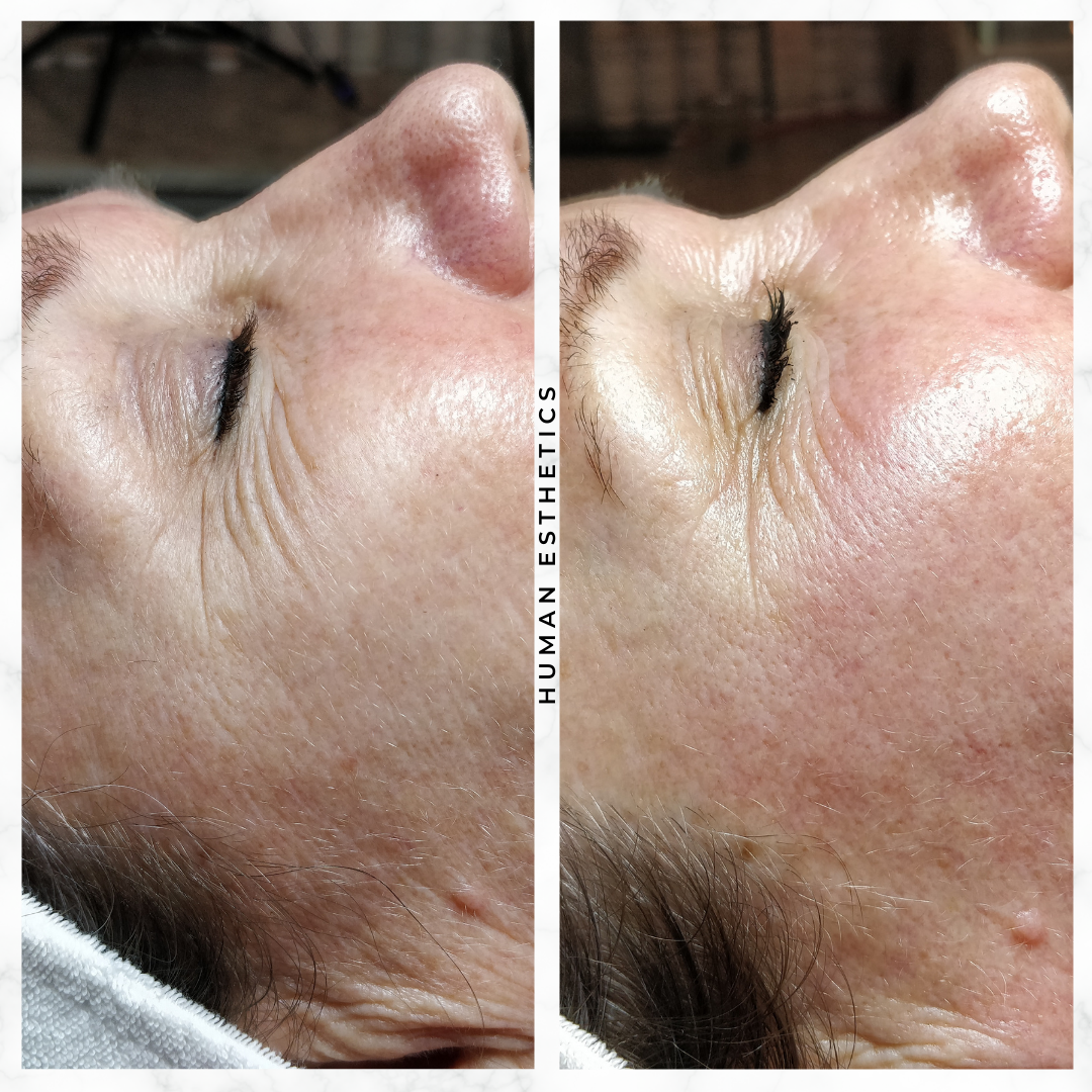photo - Human Esthetics
