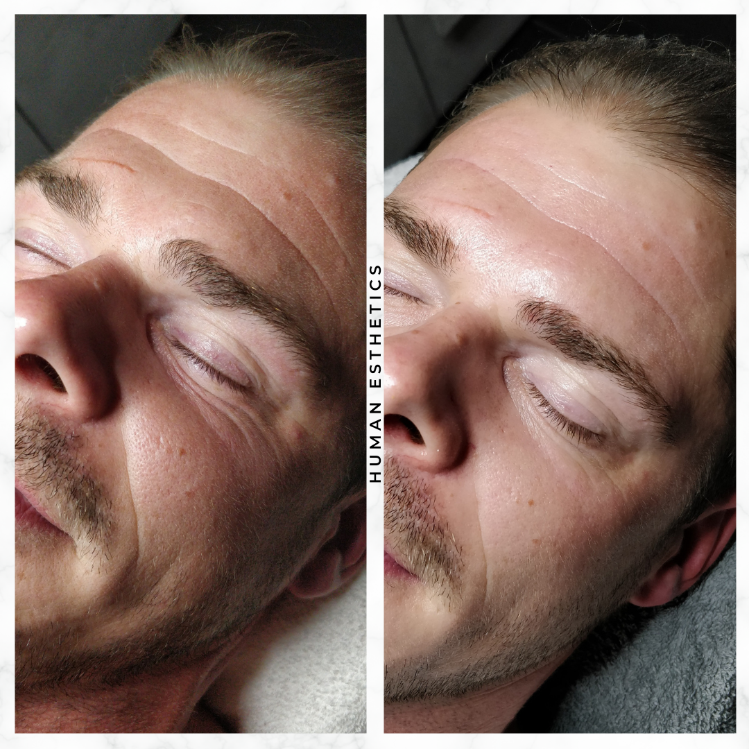 photo - Human Esthetics