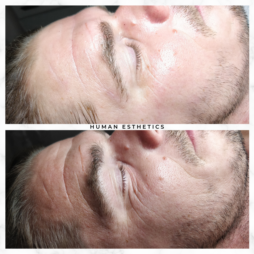 photo - Human Esthetics