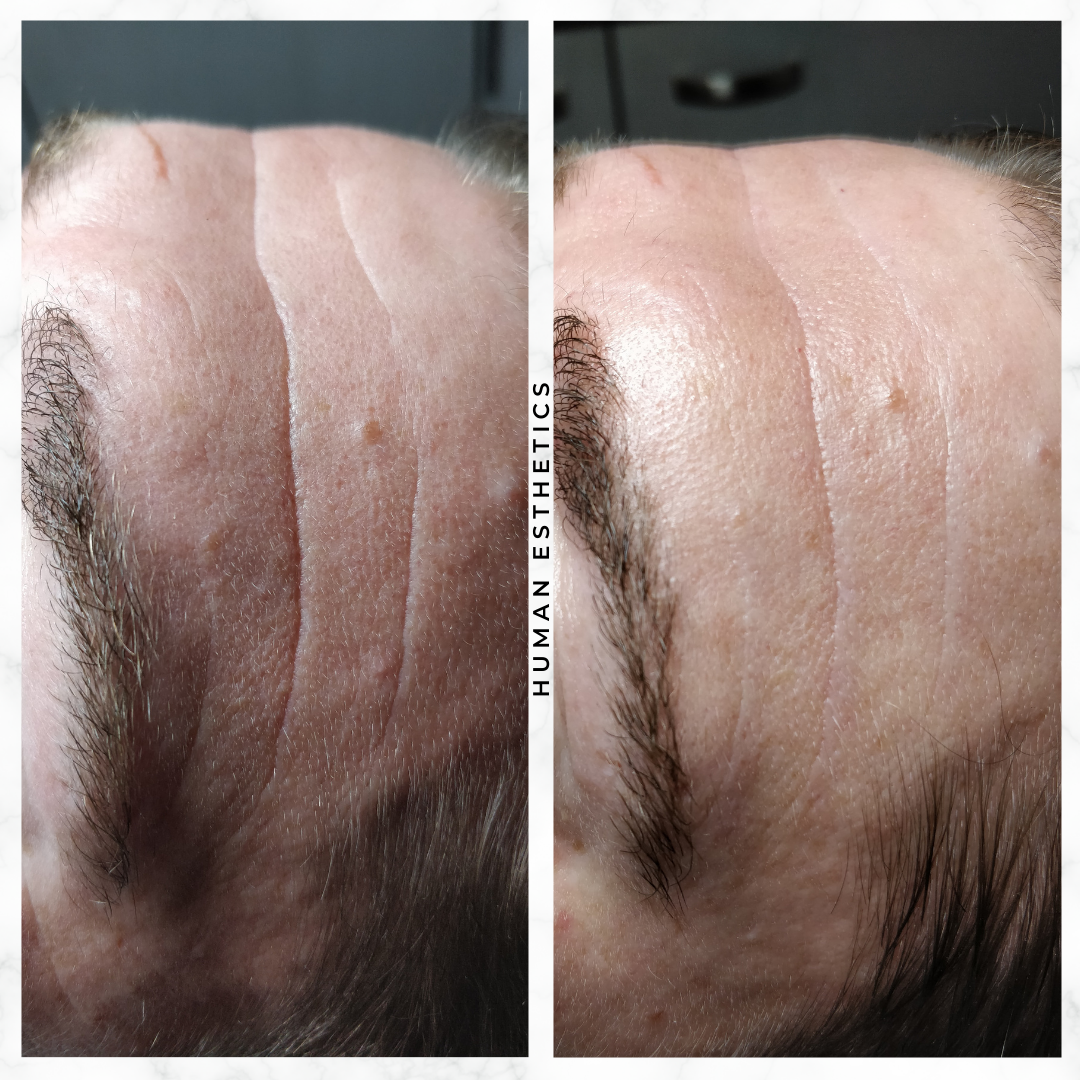 photo - Human Esthetics