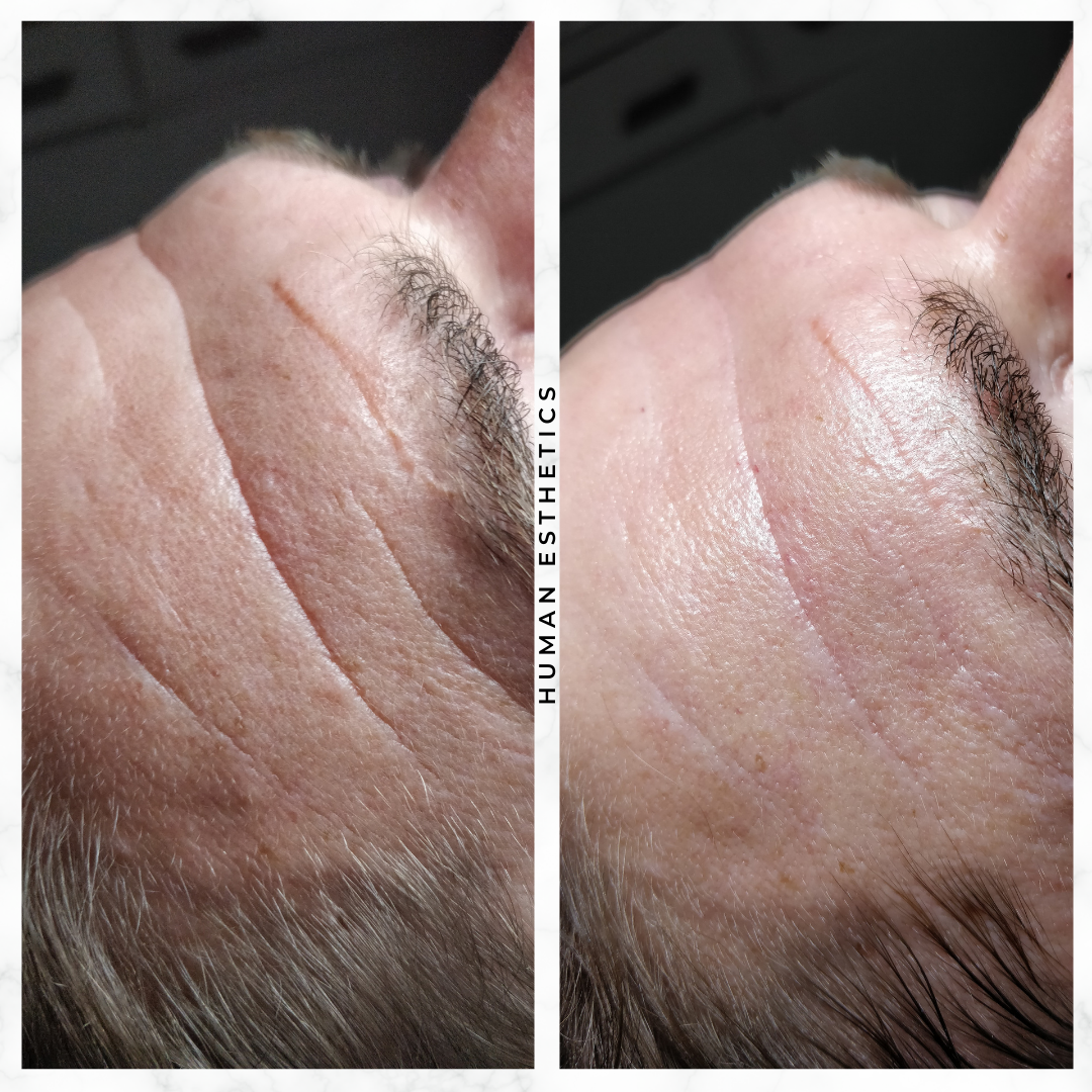 photo - Human Esthetics