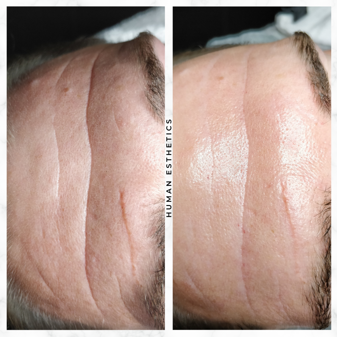 photo - Human Esthetics