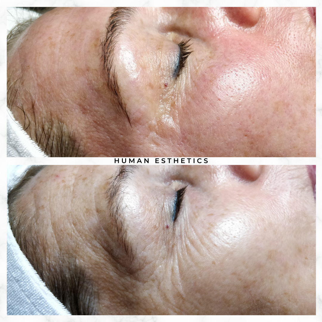photo - Human Esthetics