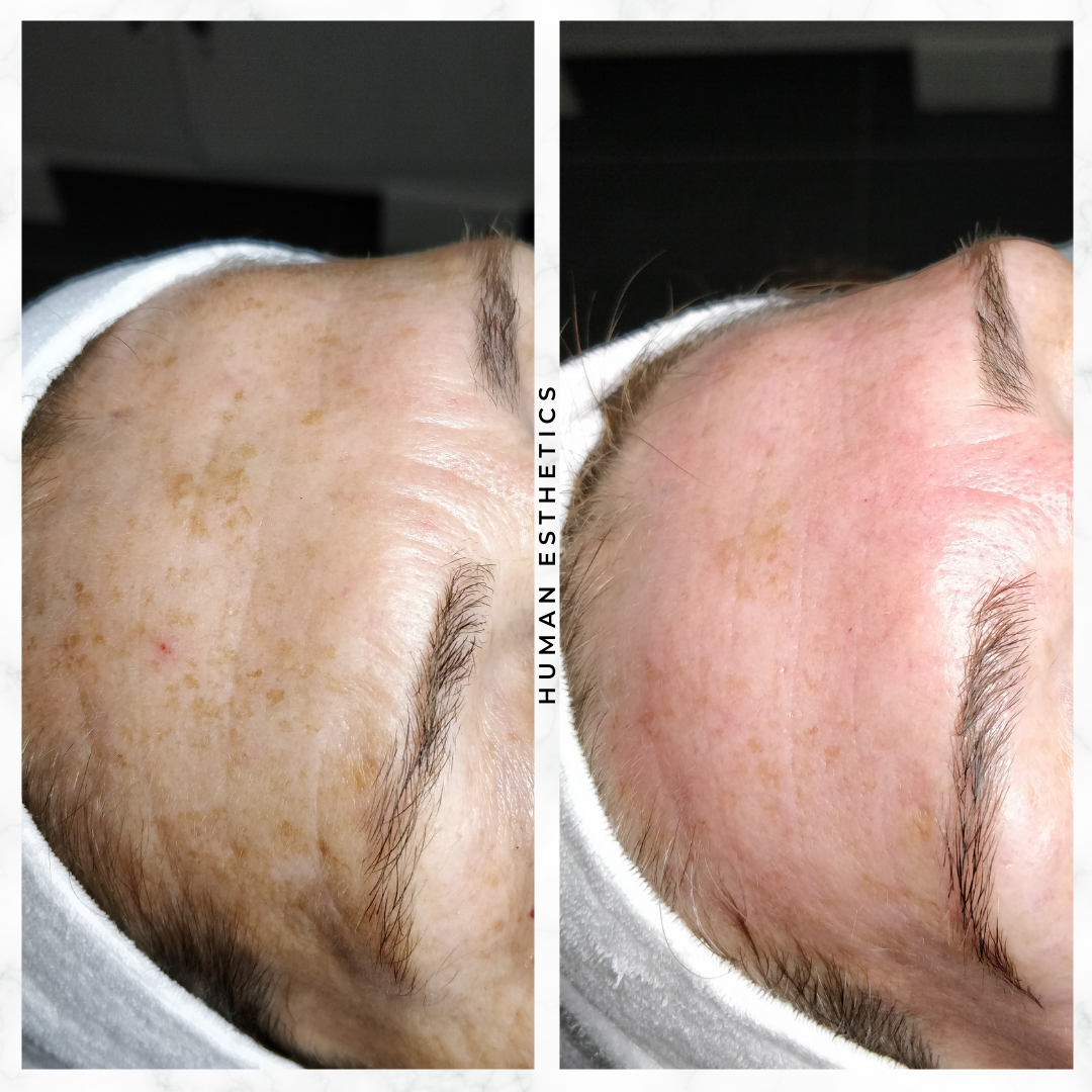 photo - Human Esthetics