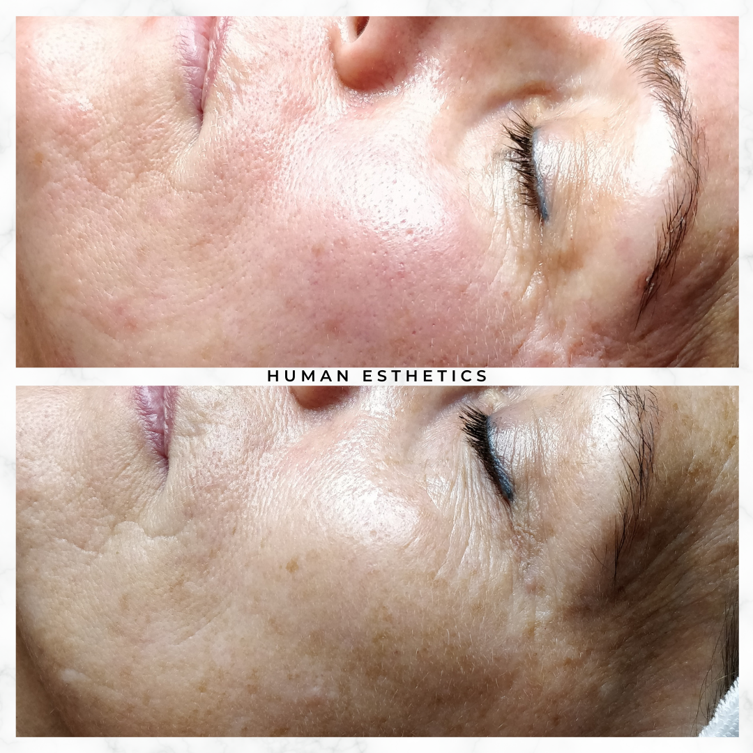 photo - Human Esthetics