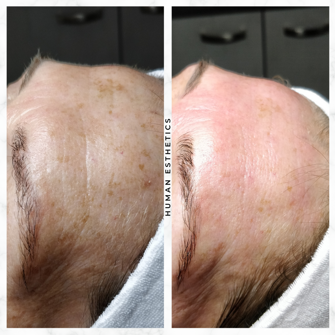 photo - Human Esthetics