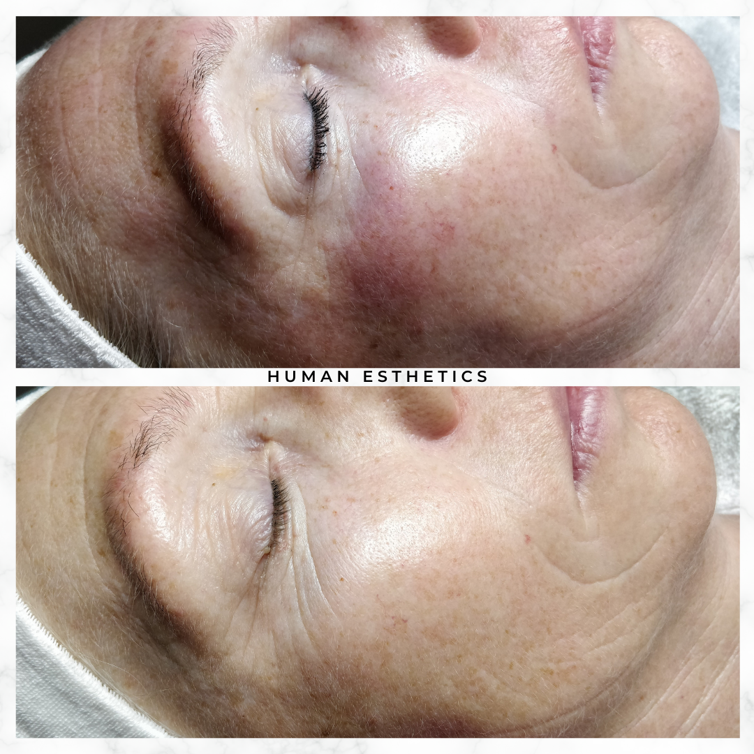 photo - Human Esthetics