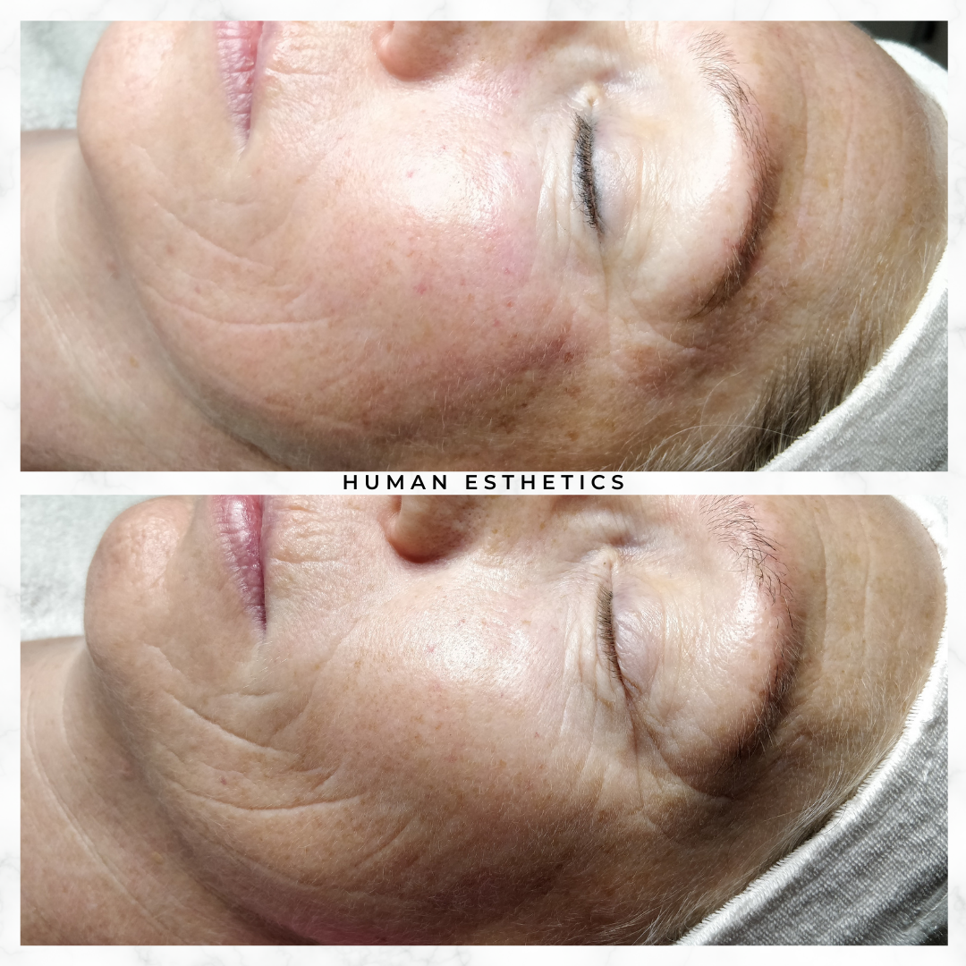 photo - Human Esthetics