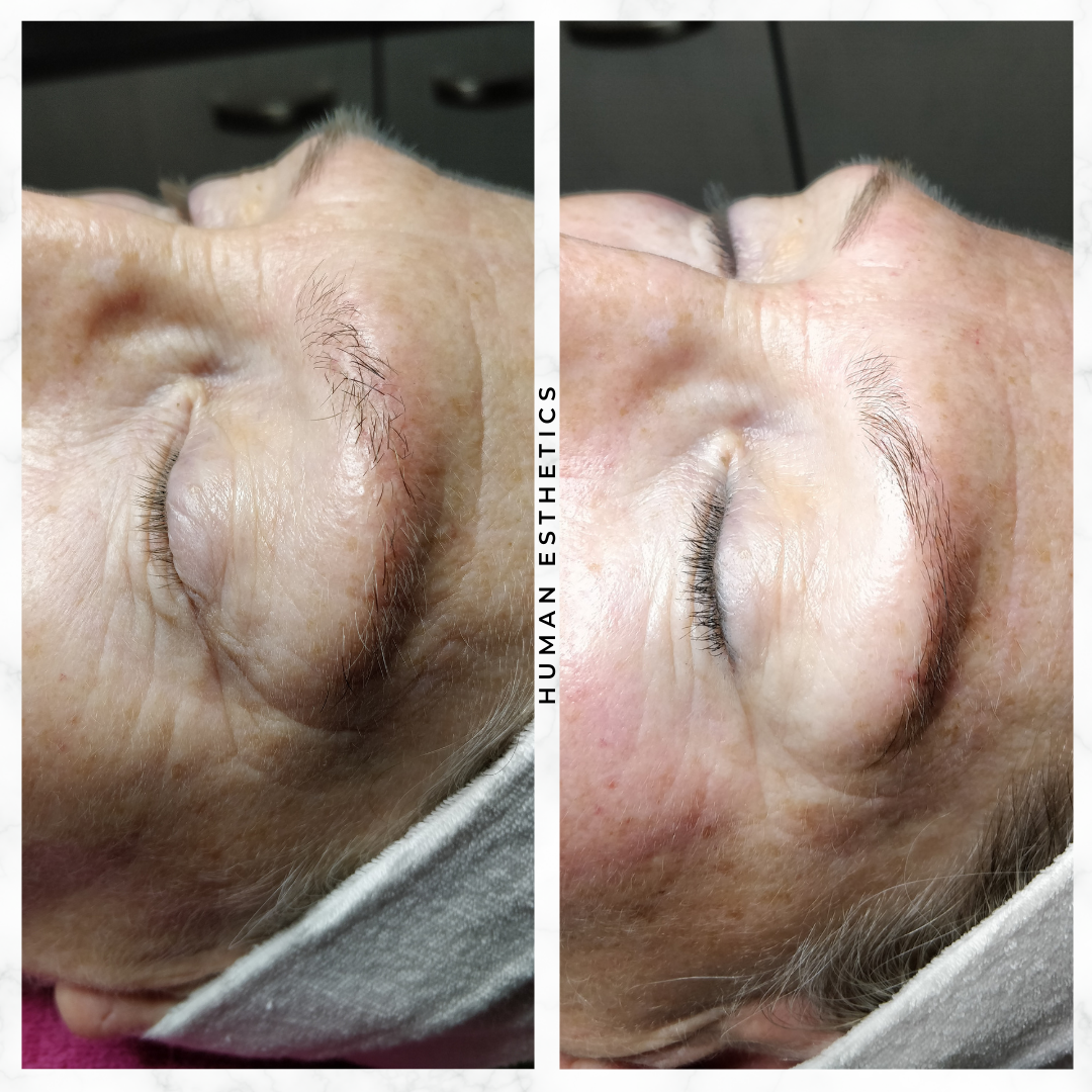 photo - Human Esthetics