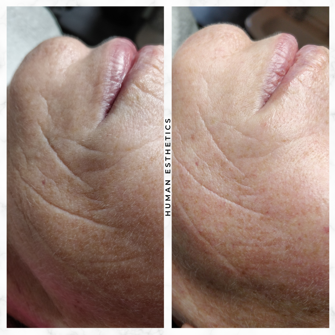 photo - Human Esthetics