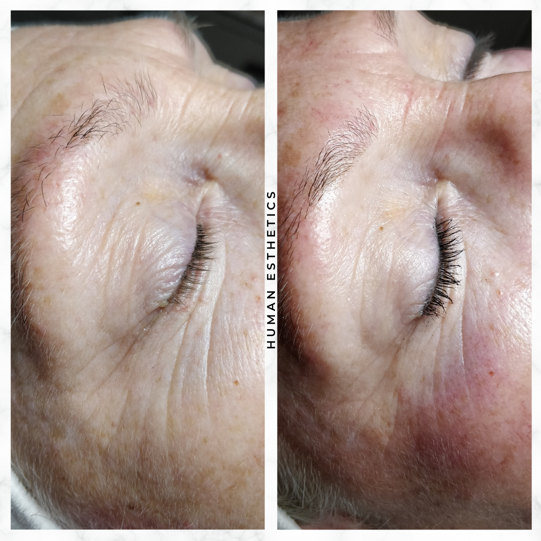 photo - Human Esthetics