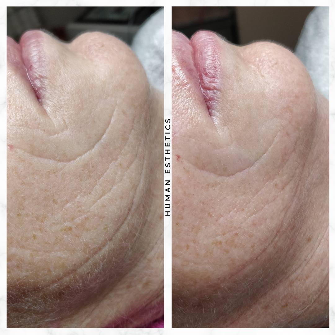 photo - Human Esthetics