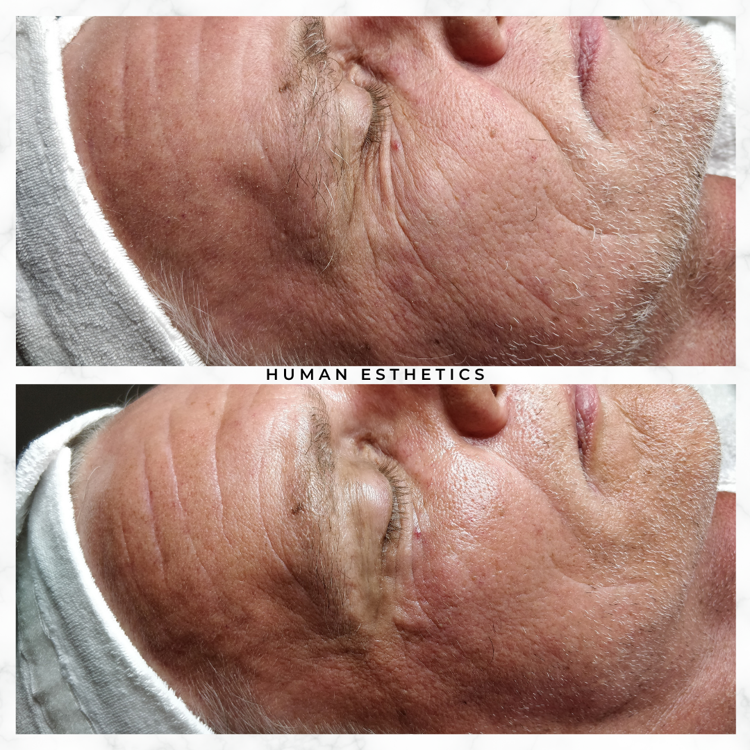 photo - Human Esthetics