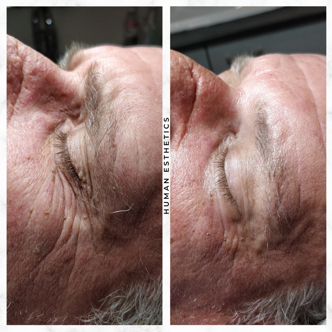 photo - Human Esthetics