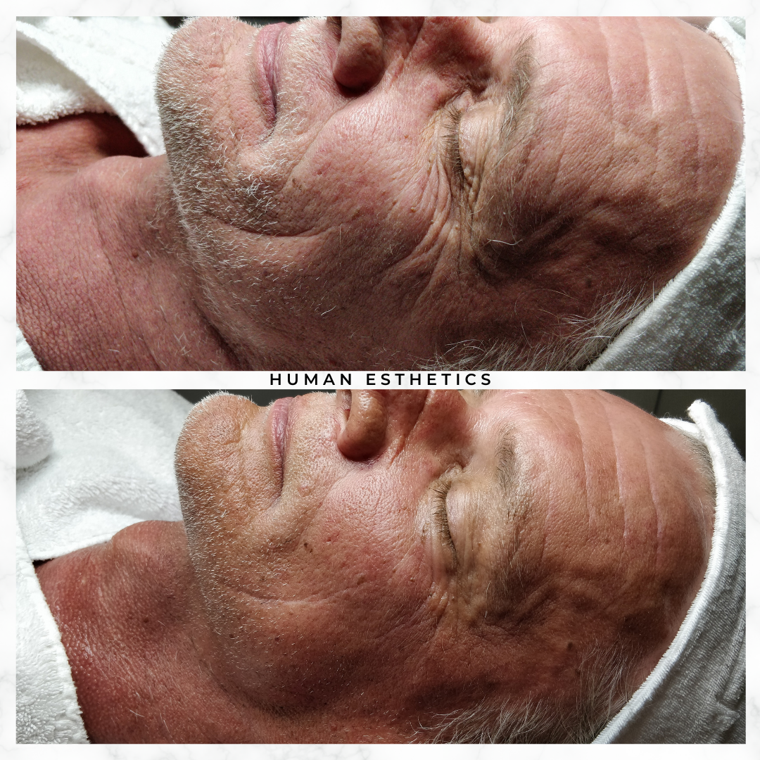 photo - Human Esthetics