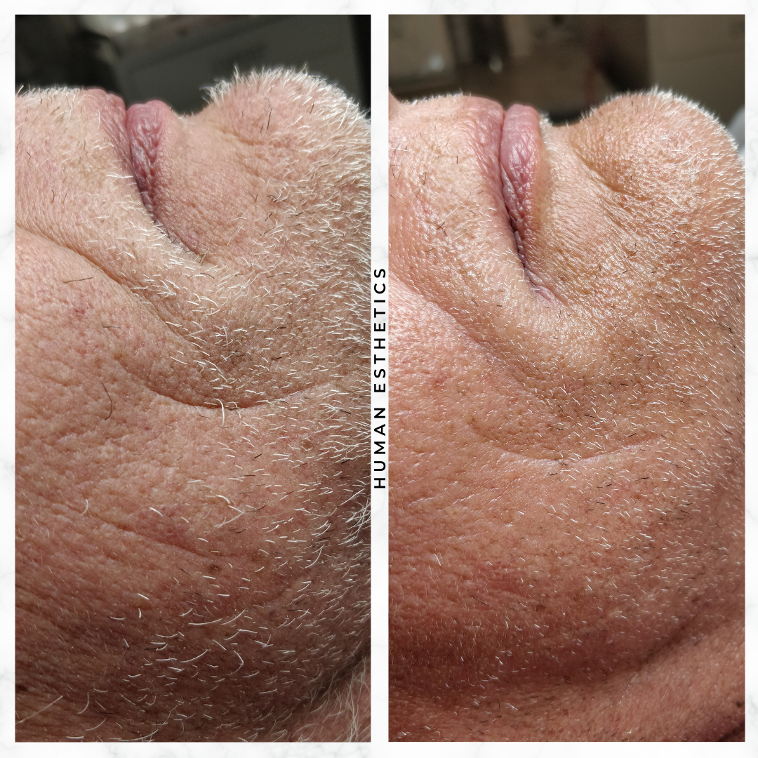 photo - Human Esthetics