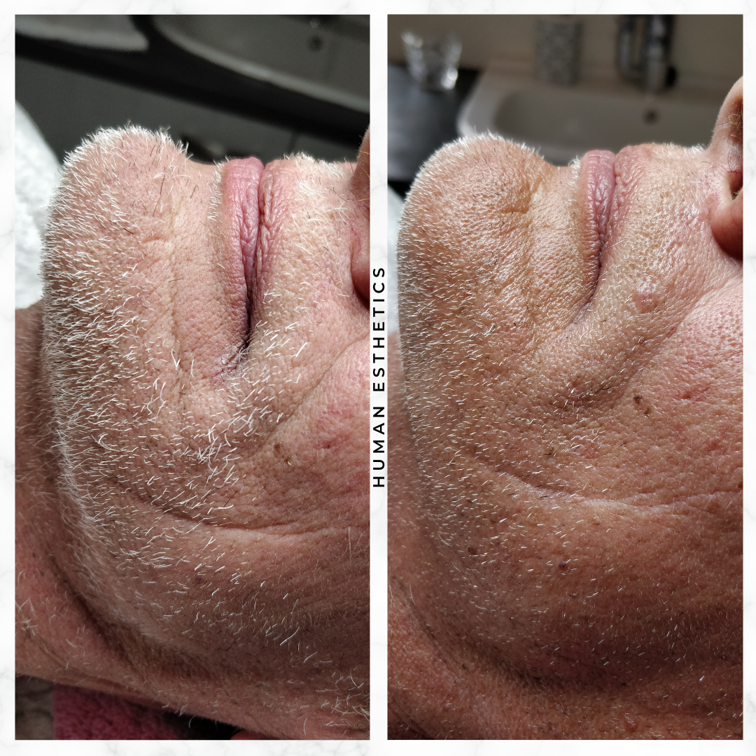 photo - Human Esthetics